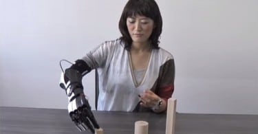 handiii bras bionique connecté