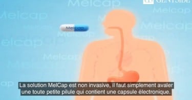 Melcap pilule connectée maigrir