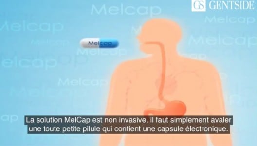 Melcap pilule connectée maigrir