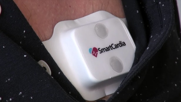 Smartcardia - Invente un objet connecté pour désengorger les hôpitaux 