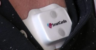 Smartcardia - Invente un objet connecté pour désengorger les hôpitaux