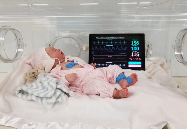 Des capteurs sans fil pour suivre la santé des bébés prématurés