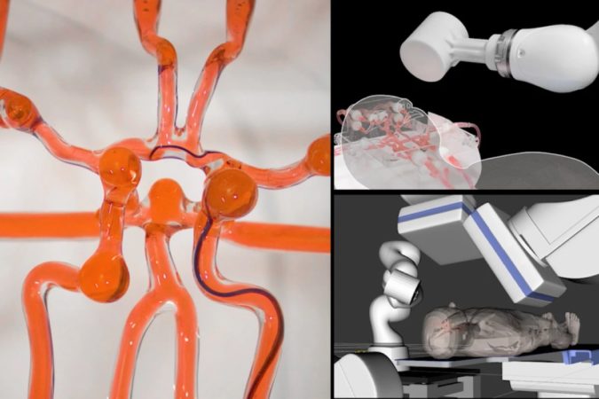 Un robot chirurgical du MIT pourrait permettre aux chirurgiens de traiter à distance les victimes d'accidents vasculaires cérébraux